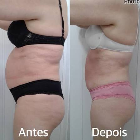 Antes e depois de Camila F. após seguir o plano alimentar